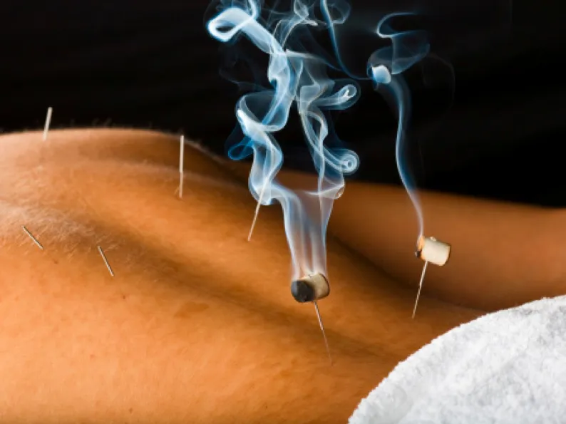 Warm needle moxibustion