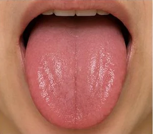 Example: little or no coating, with cracks
