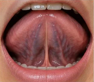 Example: dark veins under the tongue