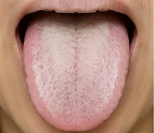 Example: thick white coating