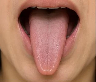 Example: thin, small tongue