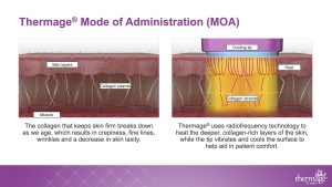Trm.0155.usa.20 Thermage Clinical Training Presentation (dragged) 2